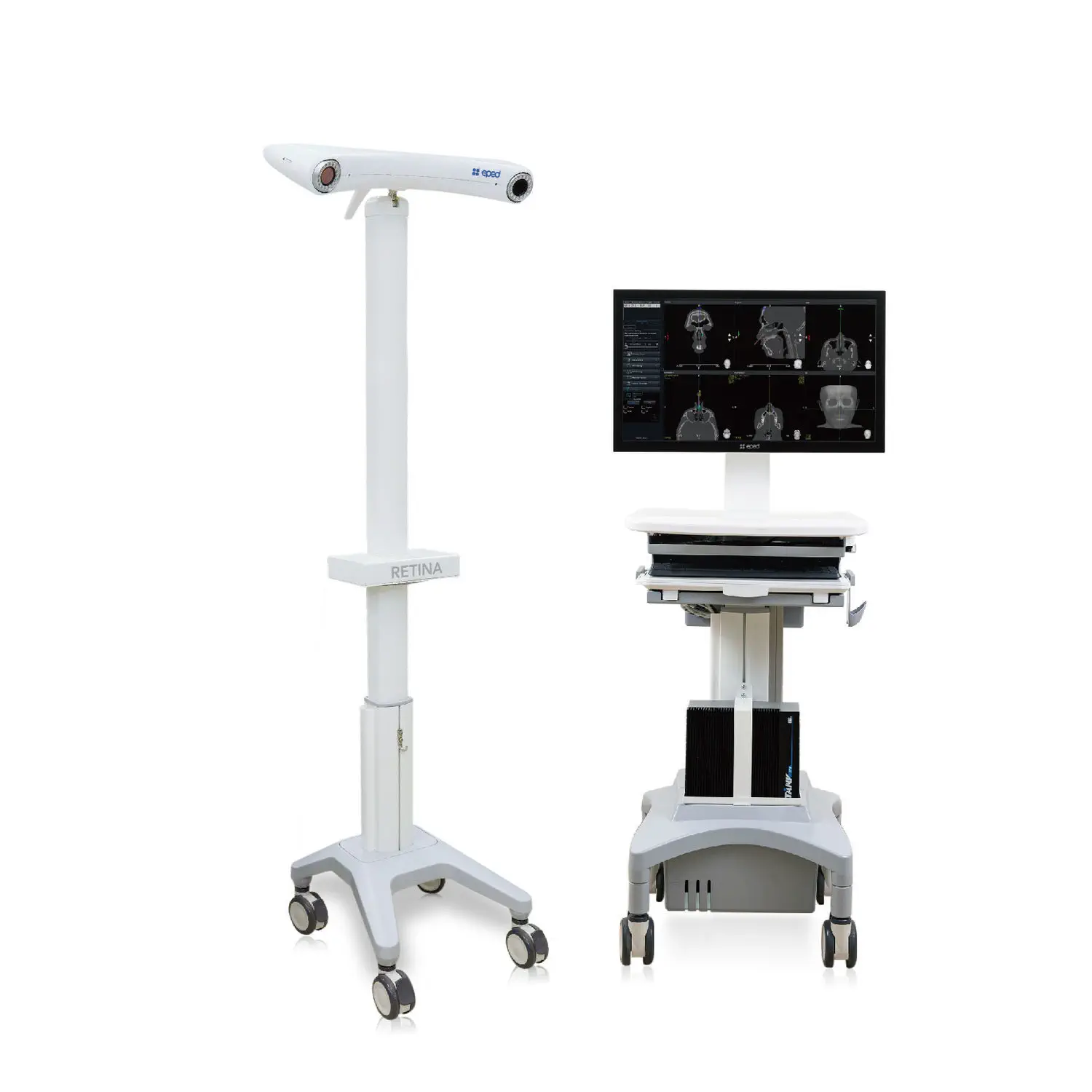 เครื่องนำวิถีผ่าตัดไซนัส  ENT surgery surgical navigation system RETINA  EPED