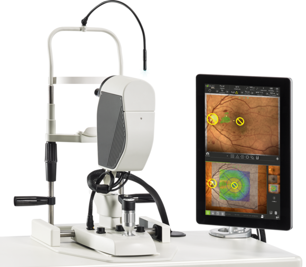 เครื่องรักษาโรคตาด้วยแสงเลเซอร์ชนิด 4 สีแบบแพทเทิน Ophthalmic  Pattern Laser with 4 Wavelength