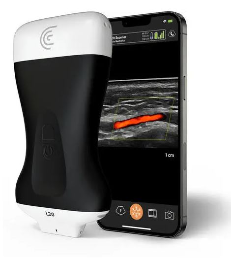 เครื่องวัดเลนส์แก้วตาเทียมด้วยคลื่นเสียงความถี่สูง  Hand-held ultrasound system L20 HD3  Clarius