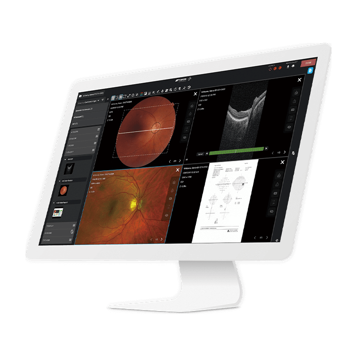 Data Management Harmony RS Topcon Healthcare