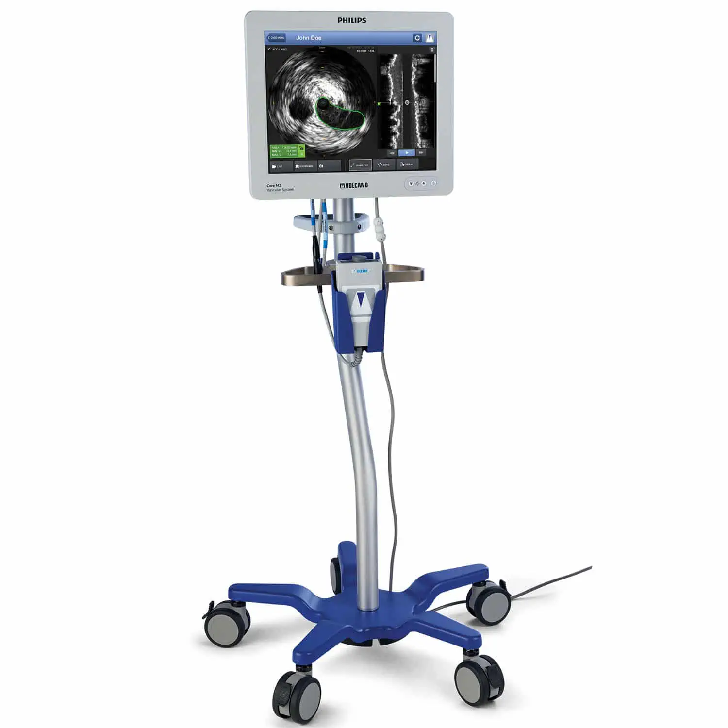 เครื่องตรวจสวนหลอดเลือดหัวใจด้วยคลื่นเสียงความถี่สูง  On-platform ultrasound system Core M2  Philips