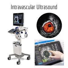 เครื่องตรวจสวนหลอดเลือดหัวใจด้วยคลื่นเสียงความถี่สูง intravascular ultrasound (IVUS)