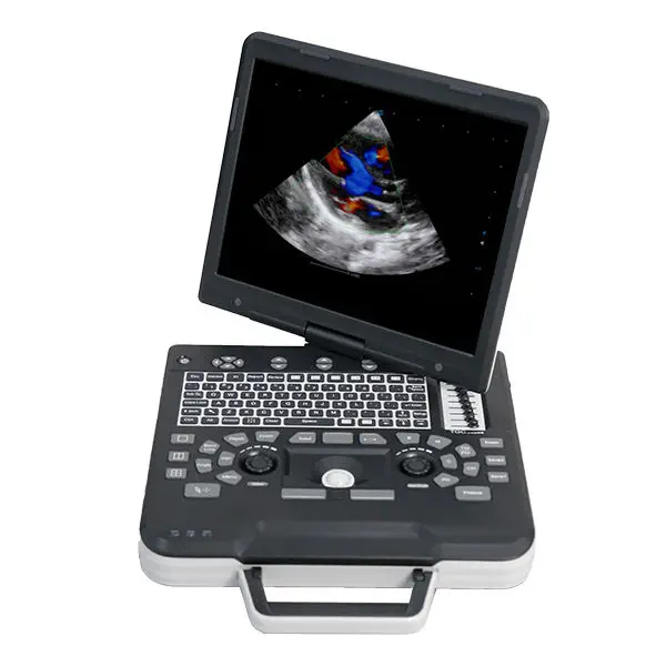 เครื่องตรวจหัวใจด้วยคลื่นเสียงความถี่สูง  Portable ultrasound system Apogee 1000 Pro  SIUI