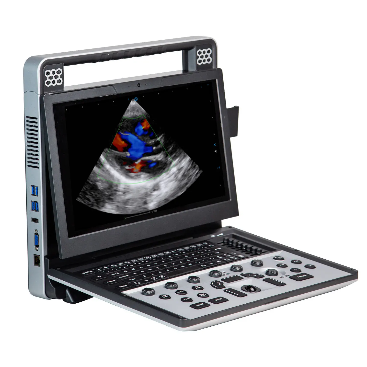 เครื่องตรวจหัวใจด้วยคลื่นเสียงความถี่สูง  Portable ultrasound system Apogee C5  SIUI
