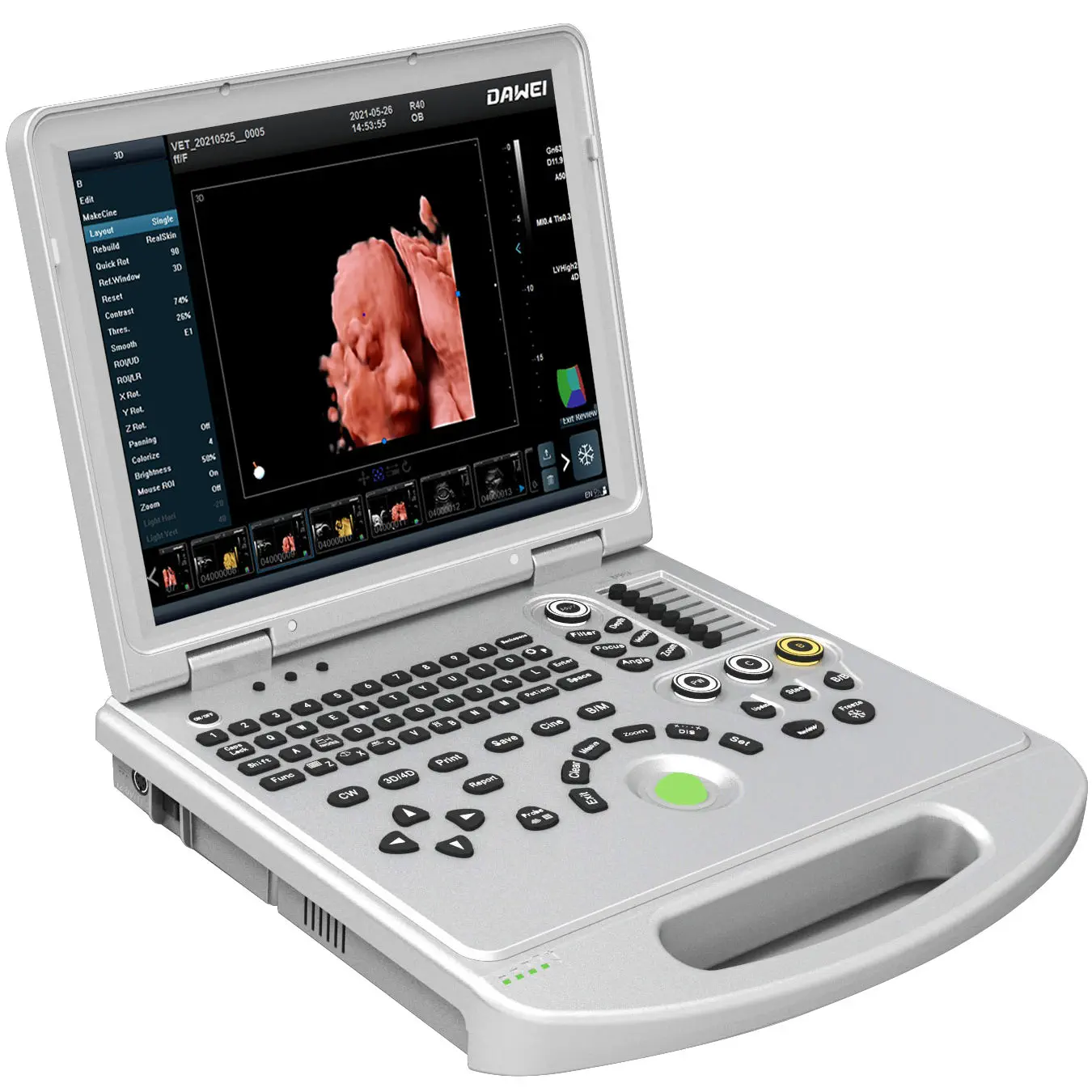เครื่องตรวจหัวใจด้วยคลื่นเสียงความถี่สูง  Portable ultrasound system DW-L50  Dawei