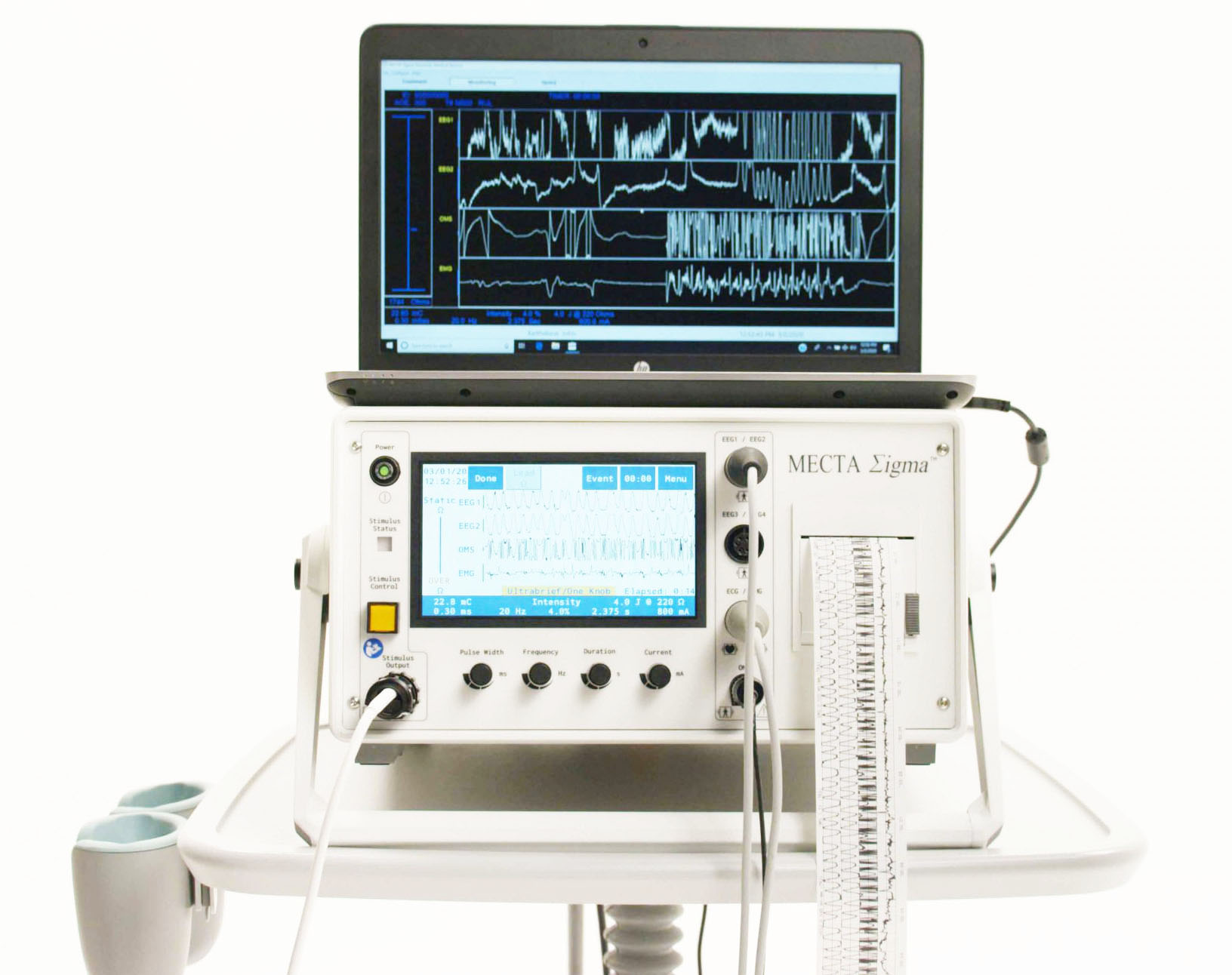 เครื่องรักษาโดยการทำให้ชักด้วยไฟฟ้า พร้อมระบบติดตาม Electroconvulsive Therapy: ECT with Monitor