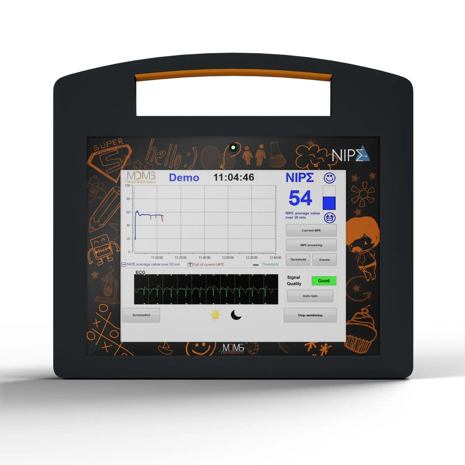 เครื่องติดตามสัญญาณประสาทขณะผ่าตัดเส้นประสาทไขสันหลัง  Intraoperative nerve monitoring system NIPE  Mdoloris Medical Systems