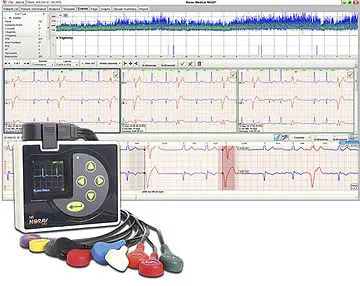 ซอฟต์แวร์วิเคราะห์สำหรับ cardiac Holter monitors Analysis software NH-301  NORAV Medical