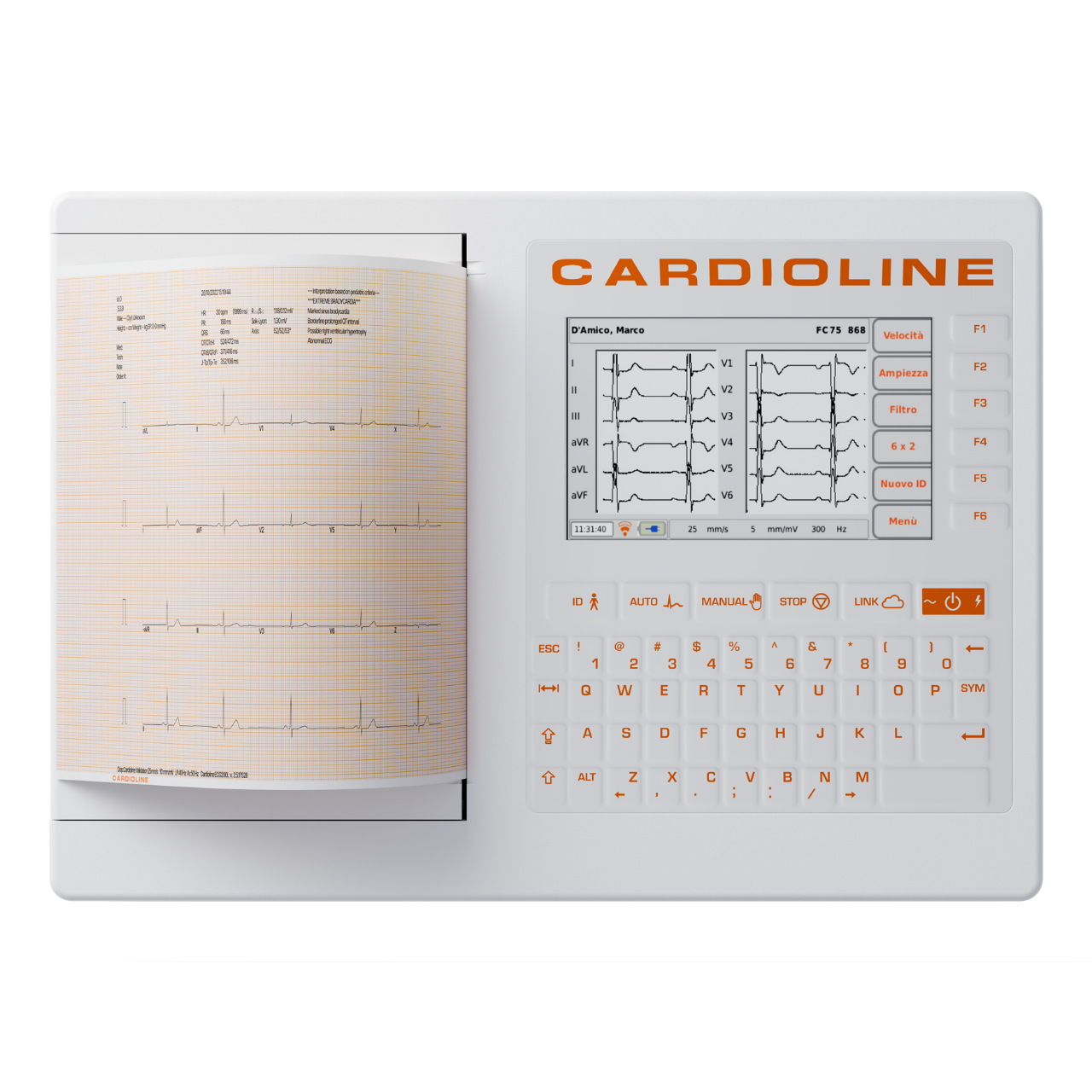 เครื่องตรวจคลื่นไฟฟ้าหัวใจ พร้อมระบบวิเคราะห์ผล  ECG200S  CARDIOLINE