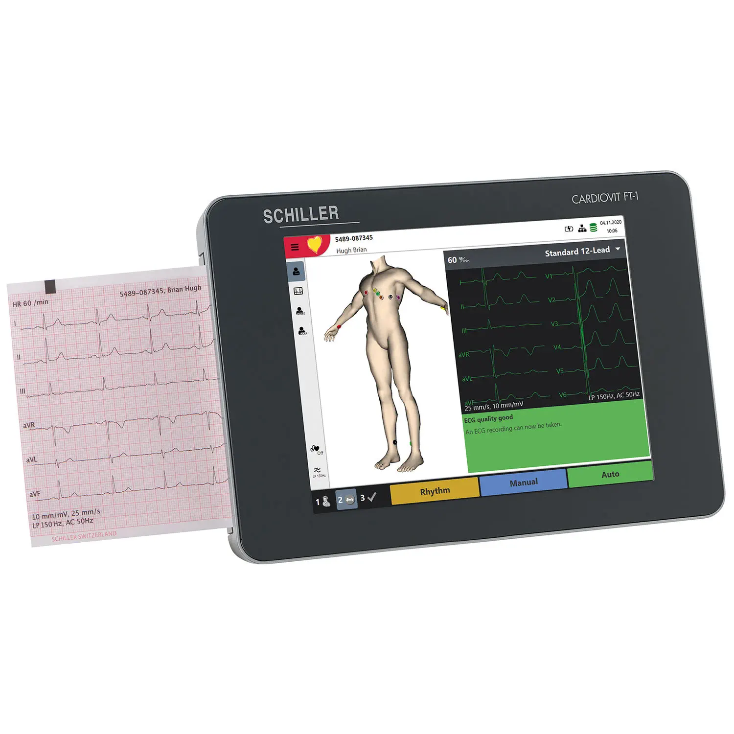 เครื่องตรวจคลื่นไฟฟ้าหัวใจ พร้อมระบบวิเคราะห์ผล  Resting electrocardiograph CARDIOVIT FT-1  SCHILLER