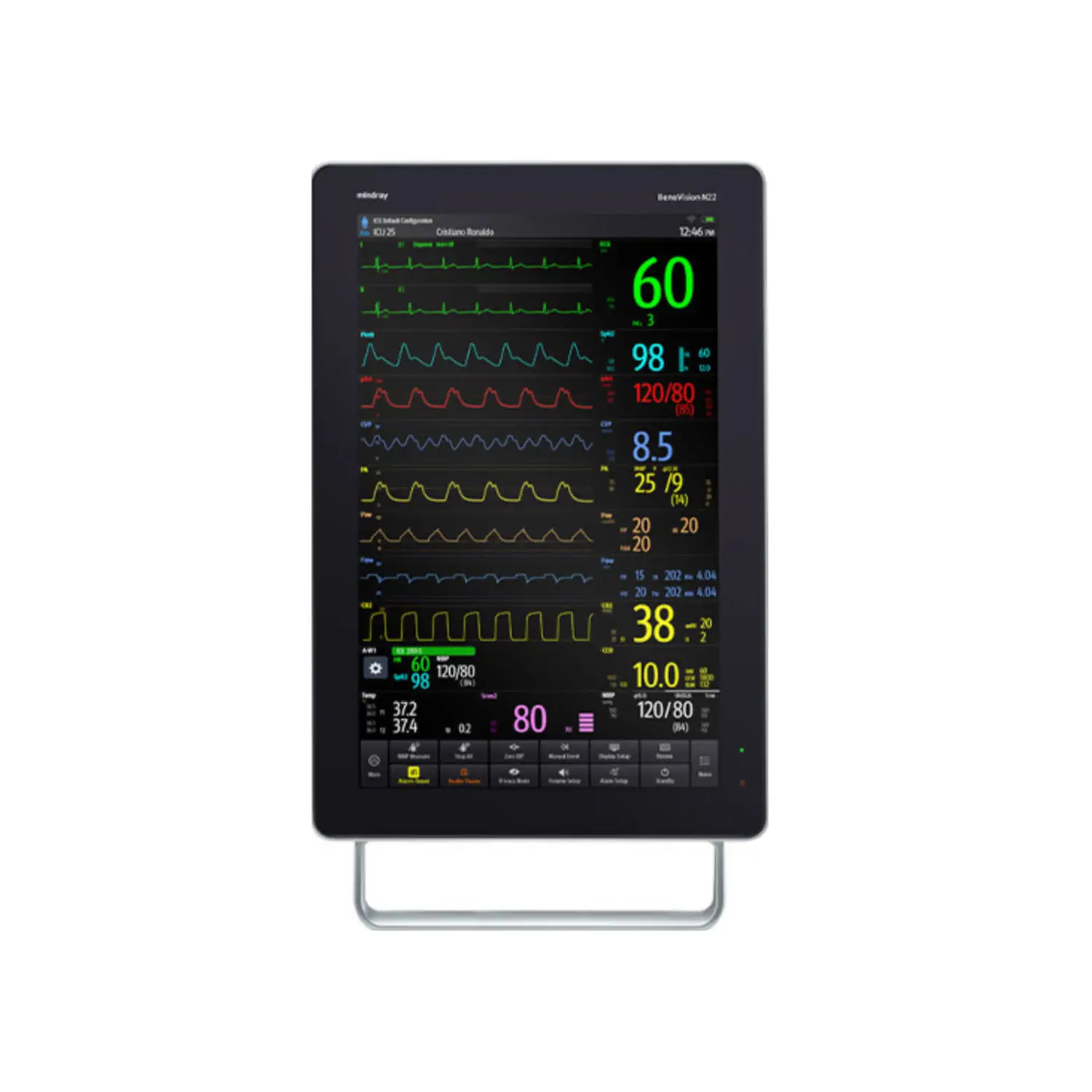 เครื่องติดตามการทำงานของหัวใจและสัญญาณชีพอัตโนมัติ  BIS patient monitor BeneVision™ N22  Mindray