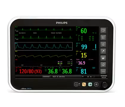 เครื่องติดตามการทำงานของหัวใจและสัญญาณชีพอัตโนมัติ  Efficia CM150 Patient Monitor  Philips