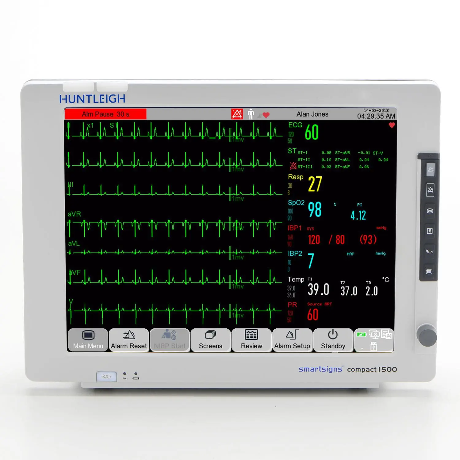 เครื่องติดตามการทำงานของหัวใจและสัญญาณชีพอัตโนมัติ  Modular patient monitor SMARTSIGNS SC1500  Huntleigh