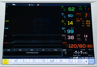 เครื่องติดตามการทำงานของหัวใจและสัญญาณชีพอัตโนมัติ  iM80 Patient Monitor  EDAN