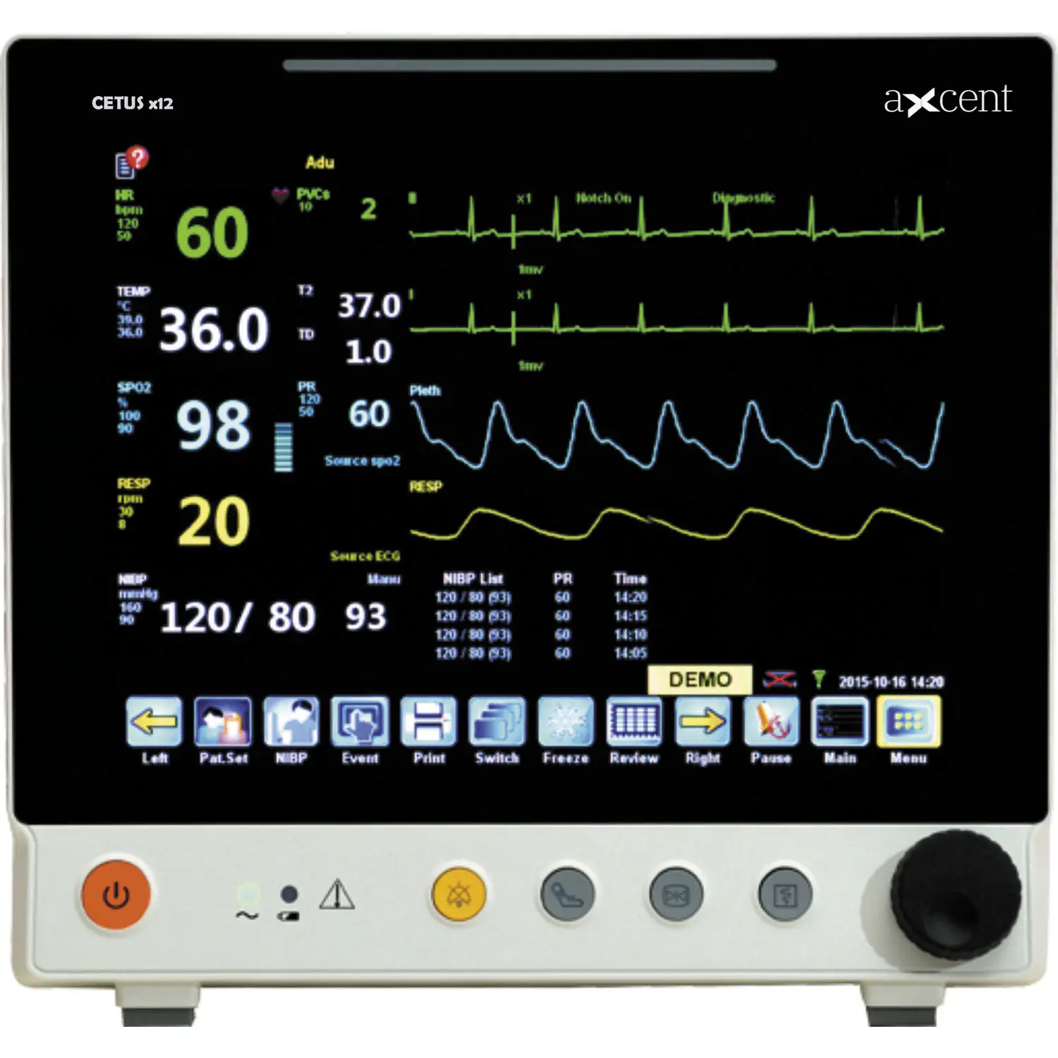 เครื่องติดตามการทำงานของหัวใจและสัญญาณชีพ  Portable patient monitor CETUS x12  aXcent medical