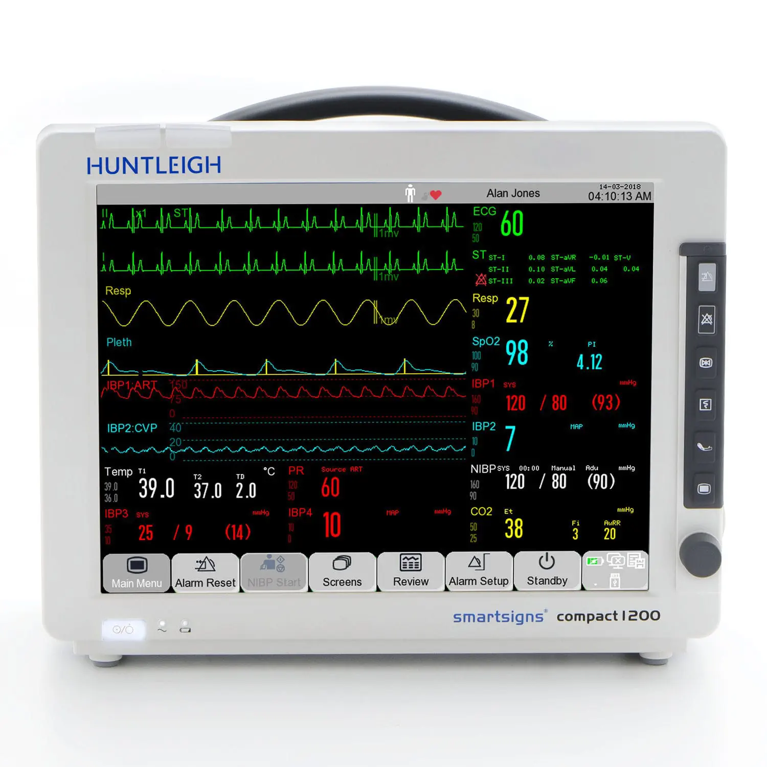 เครื่องติดตามการทำงานของหัวใจและสัญญาณชีพ  Portable patient monitor SMARTSIGNS SC1200  Huntleigh