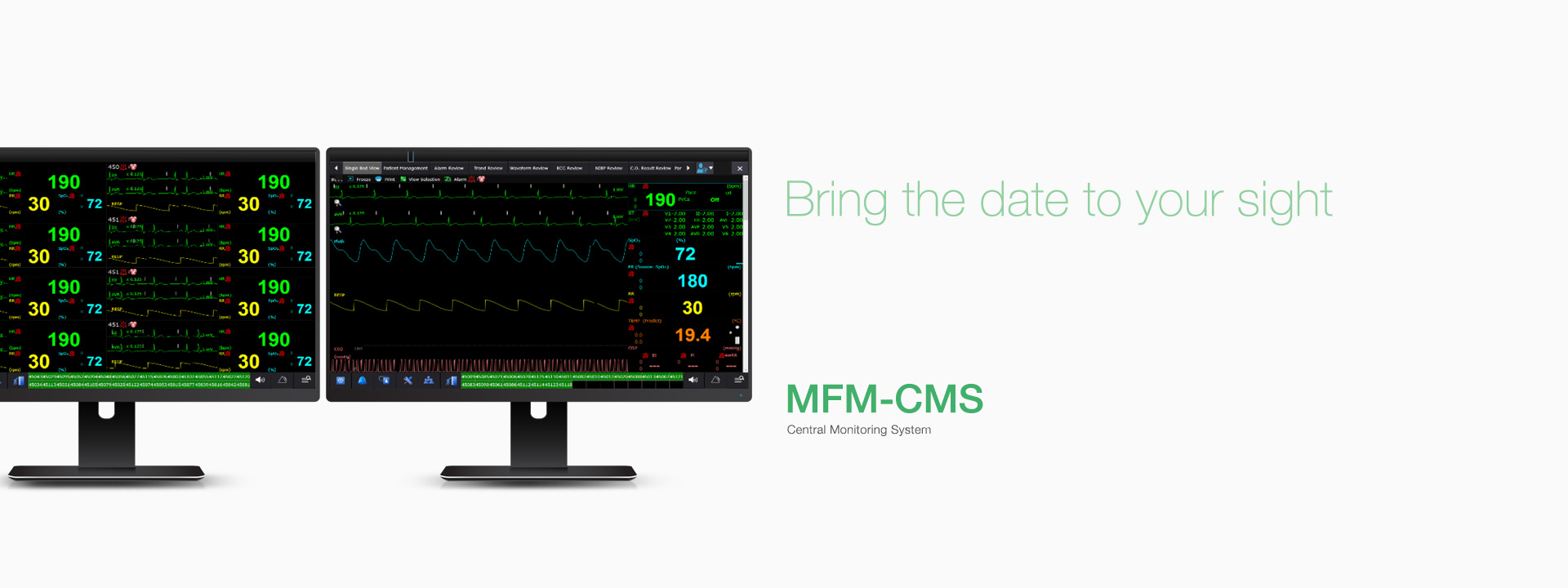 เครื่องติดตามการทำงานของหัวใจและสัญญาณชีพ 6 พารามิเตอร์ระบบรวมศูนย์  MFM-CMS Central monitoring System  EDAN