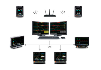 เครื่องติดตามการทำงานของหัวใจไร้สายแบบรวมศูนย์เชื่อมต่อได้มากสุด 64 เตียง Monitor CMS  N-CMS  Northern Meditec