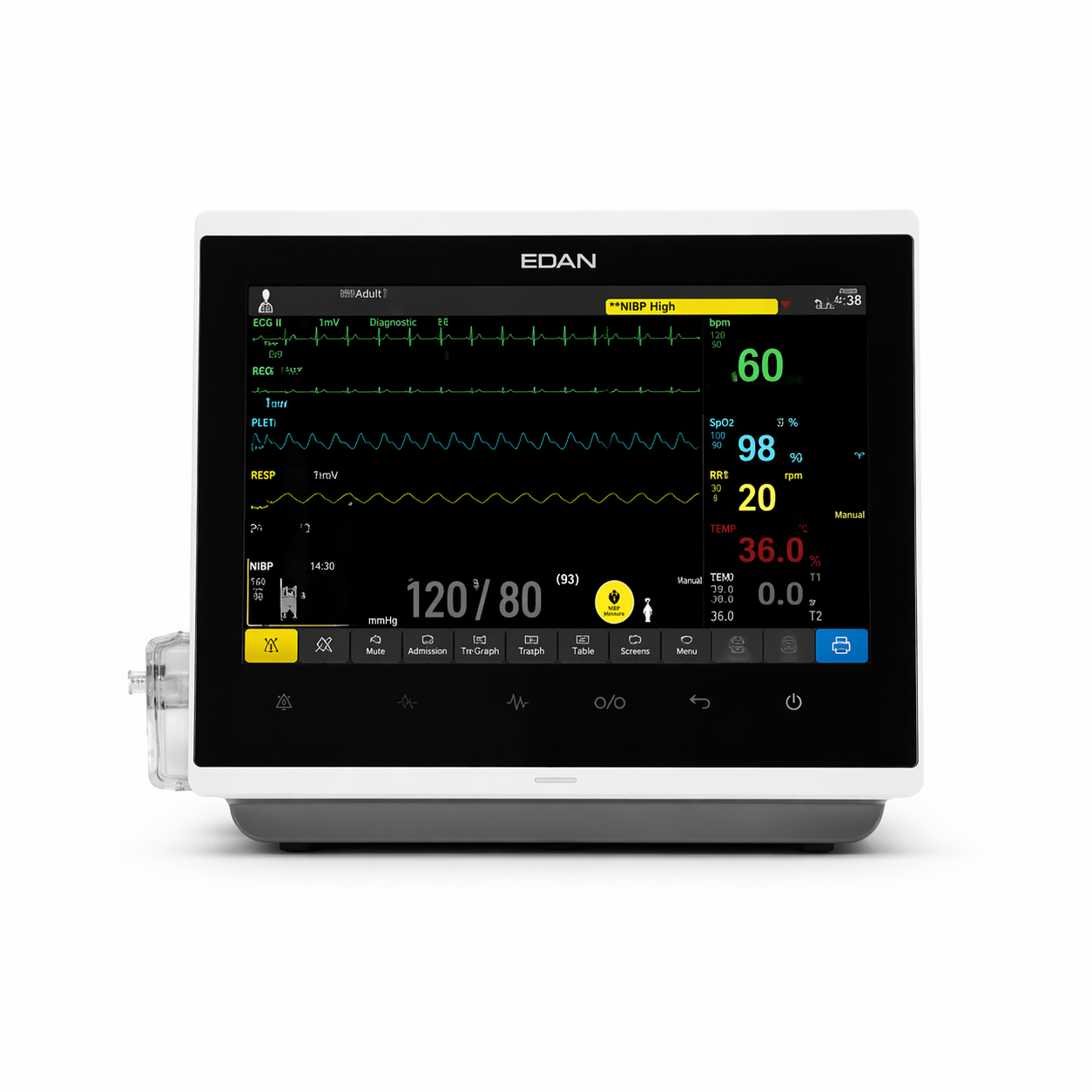 เครื่องติดตามการทำงานของหัวใจ Bedside Monitors รุ่น iX10 ยี่ห้อ EDAN