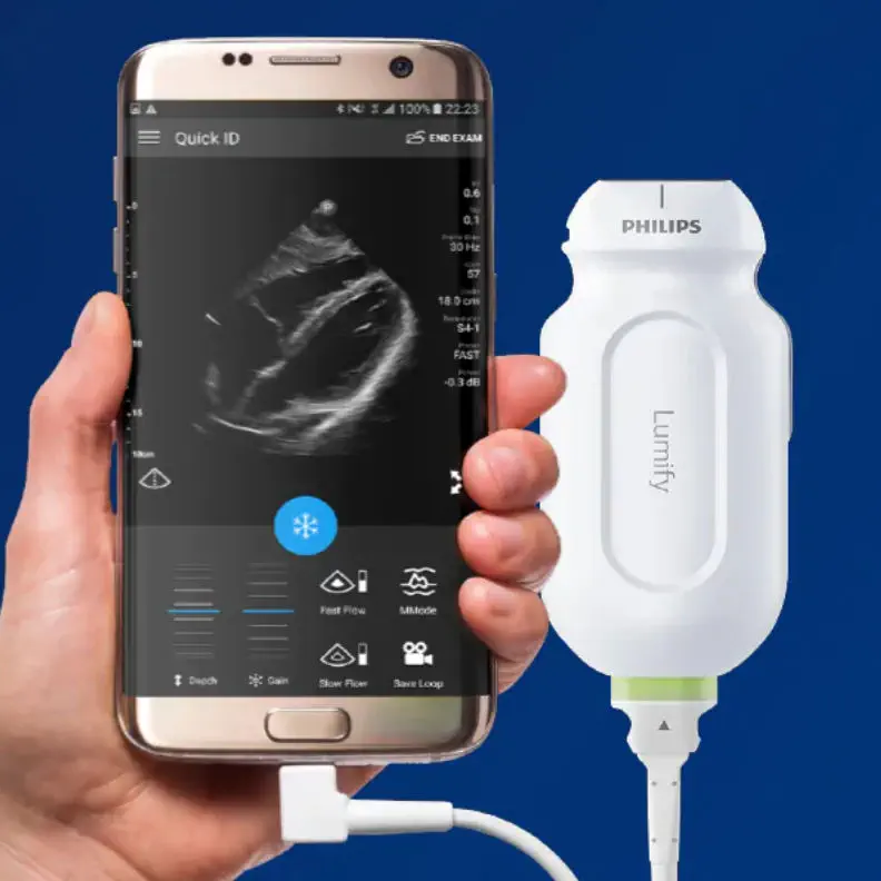 เครื่องฟังเสียงหลอดเลือดด้วยคลื่นเสียงความถี่สูงชนิดพกพา  Hand-held ultrasound system Lumify  Philips