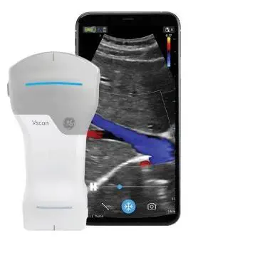 เครื่องฟังเสียงหลอดเลือดด้วยคลื่นเสียงความถี่สูงชนิดพกพา  Hand-held ultrasound system Vscan Air™  GE Healthcare