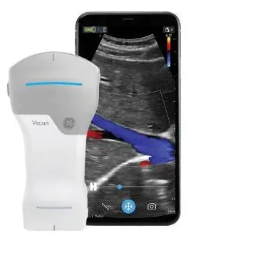 เครื่องฟังเสียงหลอดเลือดด้วยคลื่นเสียงความถี่สูงชนิดพกพา  Hand-held ultrasound system Vscan Air  GE Healthcare