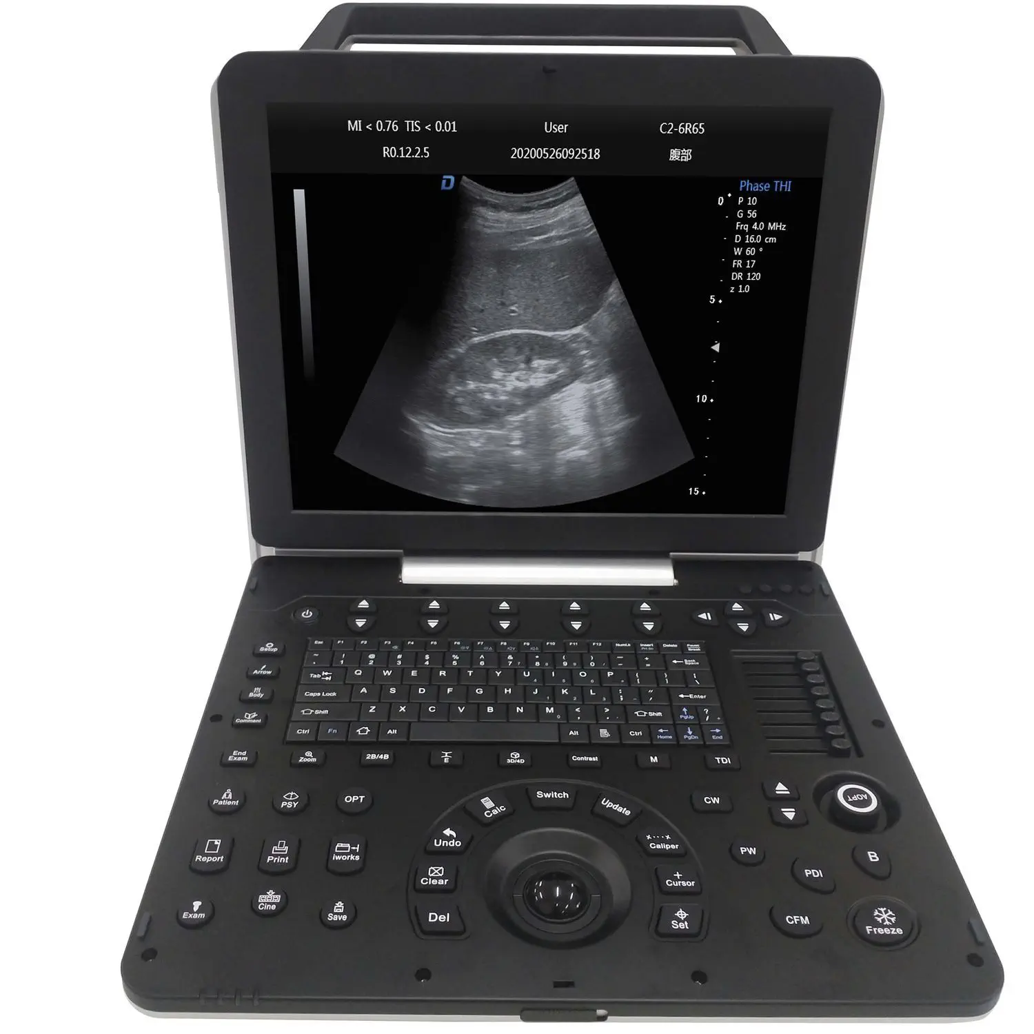 เครื่องฟังเสียงหลอดเลือดด้วยคลื่นเสียงความถี่สูงชนิดพกพา  Multipurpose ultrasound imaging system DW-P8  Dawei