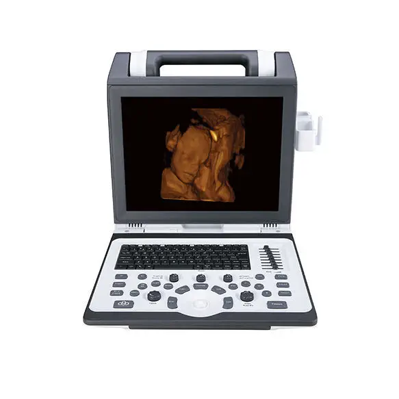 เครื่องฟังเสียงหลอดเลือดด้วยคลื่นเสียงความถี่สูงชนิดพกพา  Portable ultrasound system Apogee 2100  SIUI