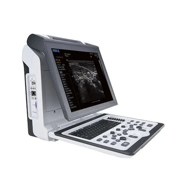 เครื่องฟังเสียงหลอดเลือดด้วยคลื่นเสียงความถี่สูงชนิดพกพา  Portable ultrasound system Apogee 2300  SIUI