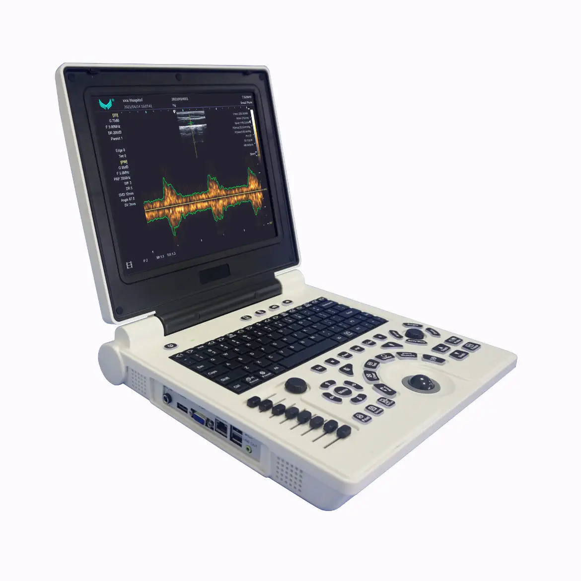 เครื่องฟังเสียงหลอดเลือดด้วยคลื่นเสียงความถี่สูงชนิดพกพา  Portable ultrasound system E20  Xianfeng Ultrasound Medical