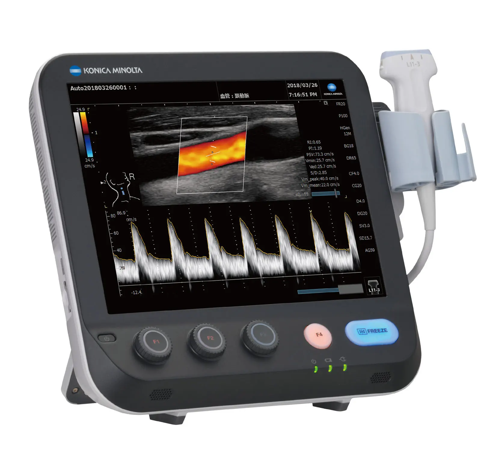 เครื่องฟังเสียงหลอดเลือดด้วยคลื่นเสียงความถี่สูงชนิดพกพา  Portable ultrasound system SONIMAGE MX1 PLATINUM  Konica Minolta