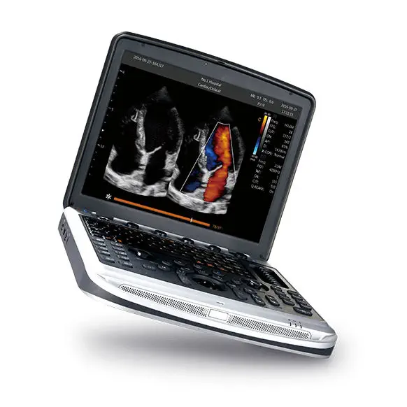 เครื่องฟังเสียงหลอดเลือดด้วยคลื่นเสียงความถี่สูงชนิดพกพา  Portable ultrasound system SonoBook 8  CHISON