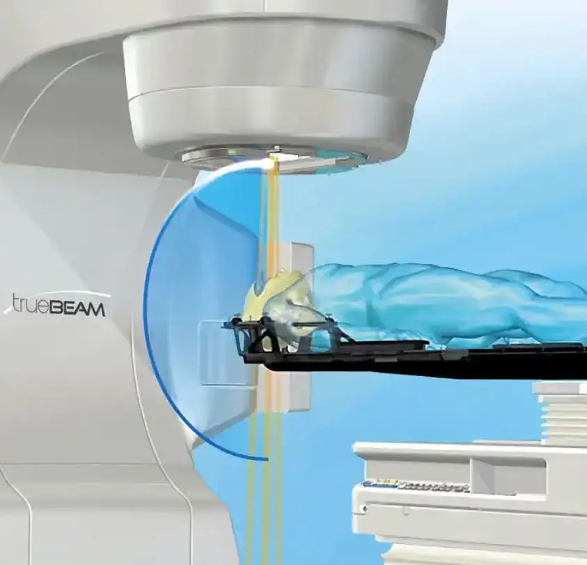 ชุดเพิ่มประสิทธิภาพเพื่อทำรังสีศัลยกรรมสำหรับเครื่องฉายรังสี  Stereotactic radiosurgery linear particle accelerator HyperArc  Varian