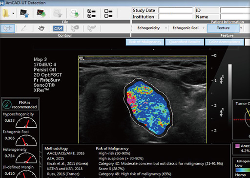 โปรแกรมอัจฉริยะประเมินผลวินิจฉัยภาวะมะเร็งไทรอยด์  AmCAD UT  AmCAD