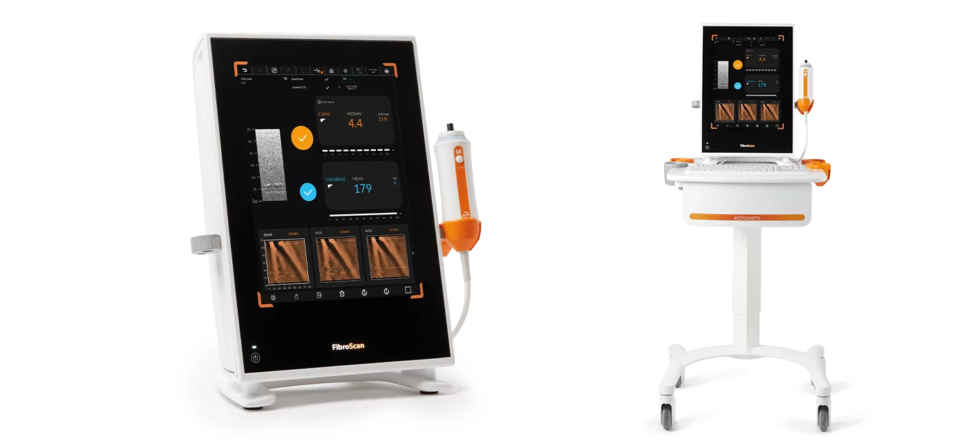 เครื่องตรวจหาภาวะพังผืดในตับและตรวจวัดปริมาณไขมันสะสมในตับ FibroScan® Compact 530 Echosens