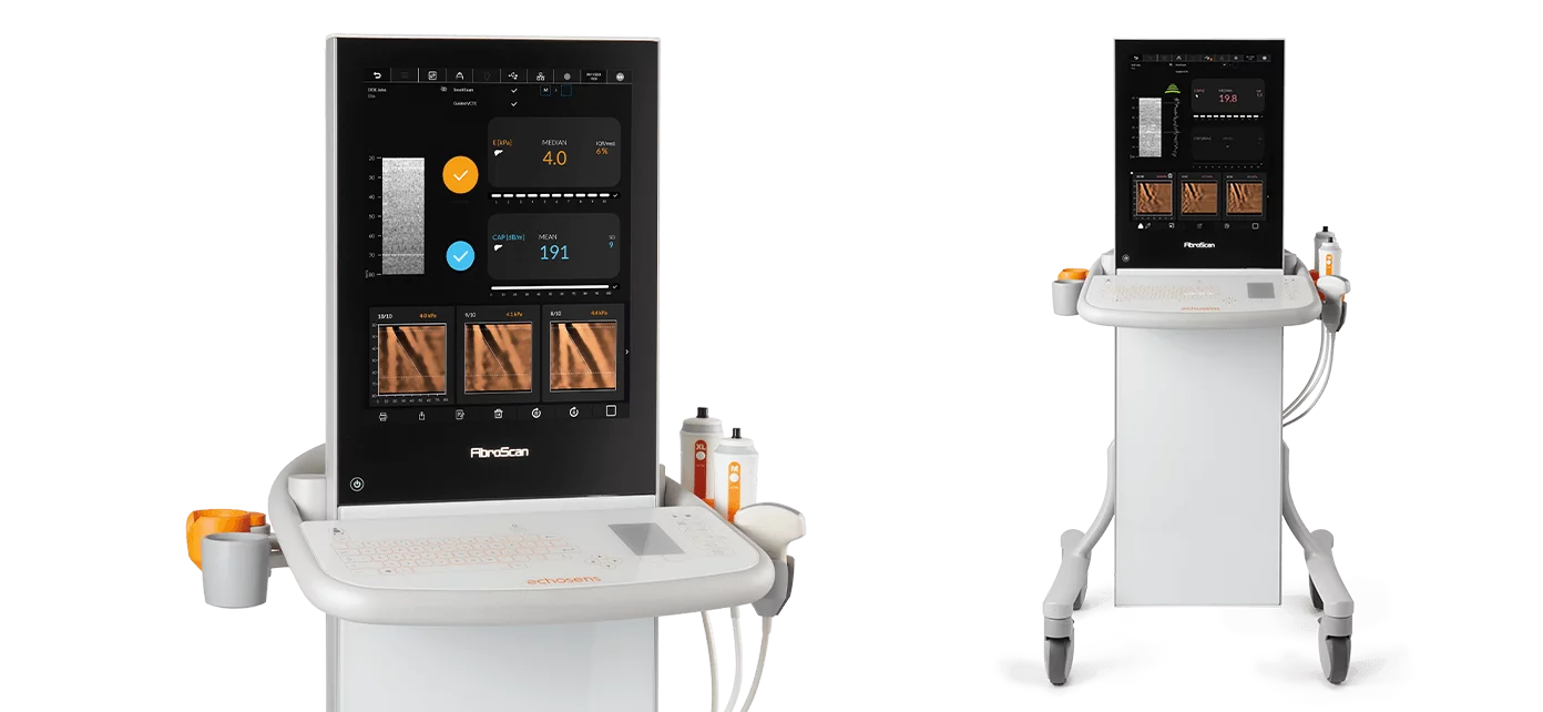 เครื่องตรวจหาภาวะพังผืดในตับ ตรวจวัดปริมาณไขมันสะสมในตับและม้าม FibroScan® Expert 630 Echosens