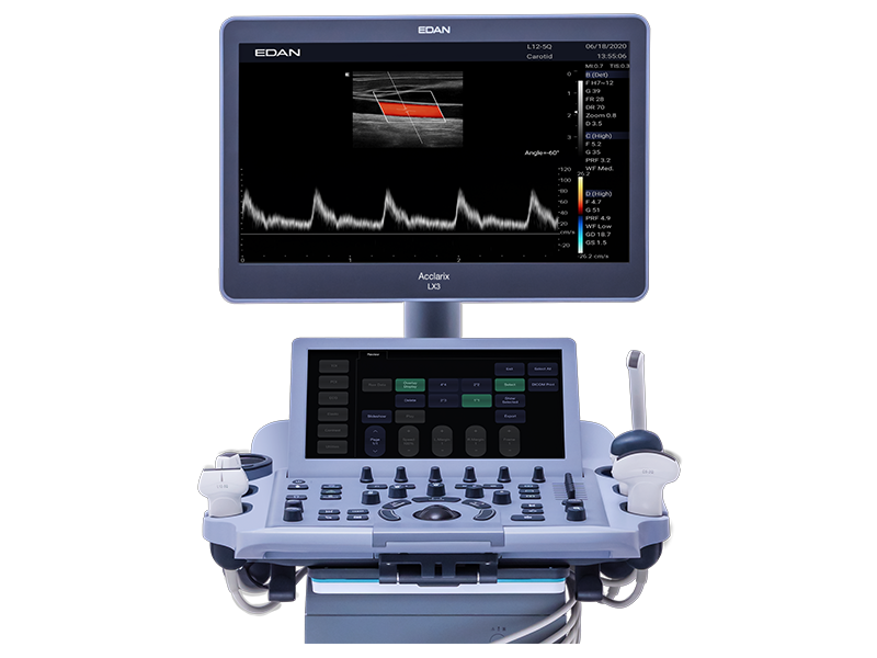 เครื่องตรวจอวัยวะภายในด้วยคลื่นเสียงความคมชัดสูง ชนิดสีระดับสูง Ultrasound diagnotic system  Acclarix LX3  EDAN