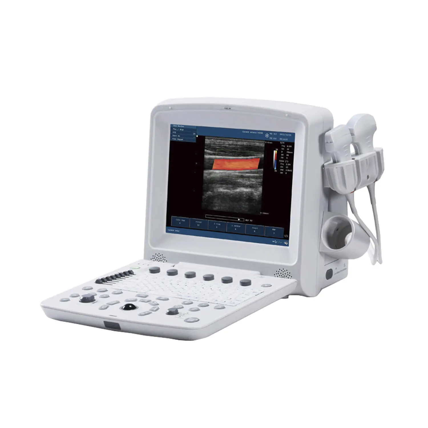 เครื่องตรวจอวัยวะภายในด้วยคลื่นเสียงความคมชัดสูงแบบพกพา  Portable ultrasound system Crystal 4P  Avante