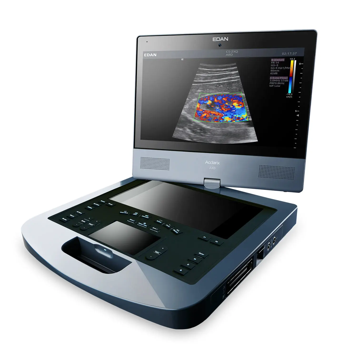 เครื่องตรวจอวัยวะภายในด้วยคลื่นเสียงความคมชัดสูงแบบพกพา  Portable ultrasound system Edan Acclarix AX8  Avante
