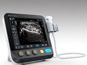 เครื่องตรวจอวัยวะภายในด้วยคลื่นเสียงความคมชัดสูงแบบพกพา  Portable ultrasound system SONIMAGE MX1  Konica Minolta