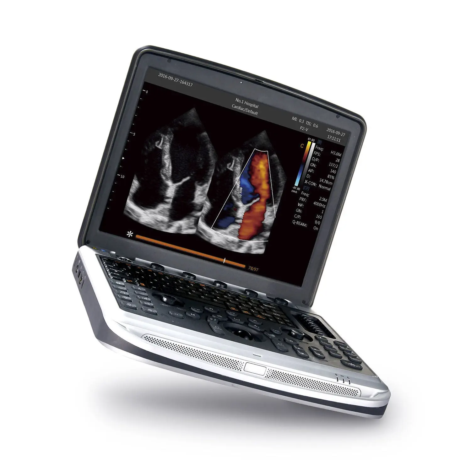 เครื่องตรวจอวัยวะภายในด้วยคลื่นเสียงความคมชัดสูงแบบพกพา  Portable ultrasound system SonoBook 9  CHISON