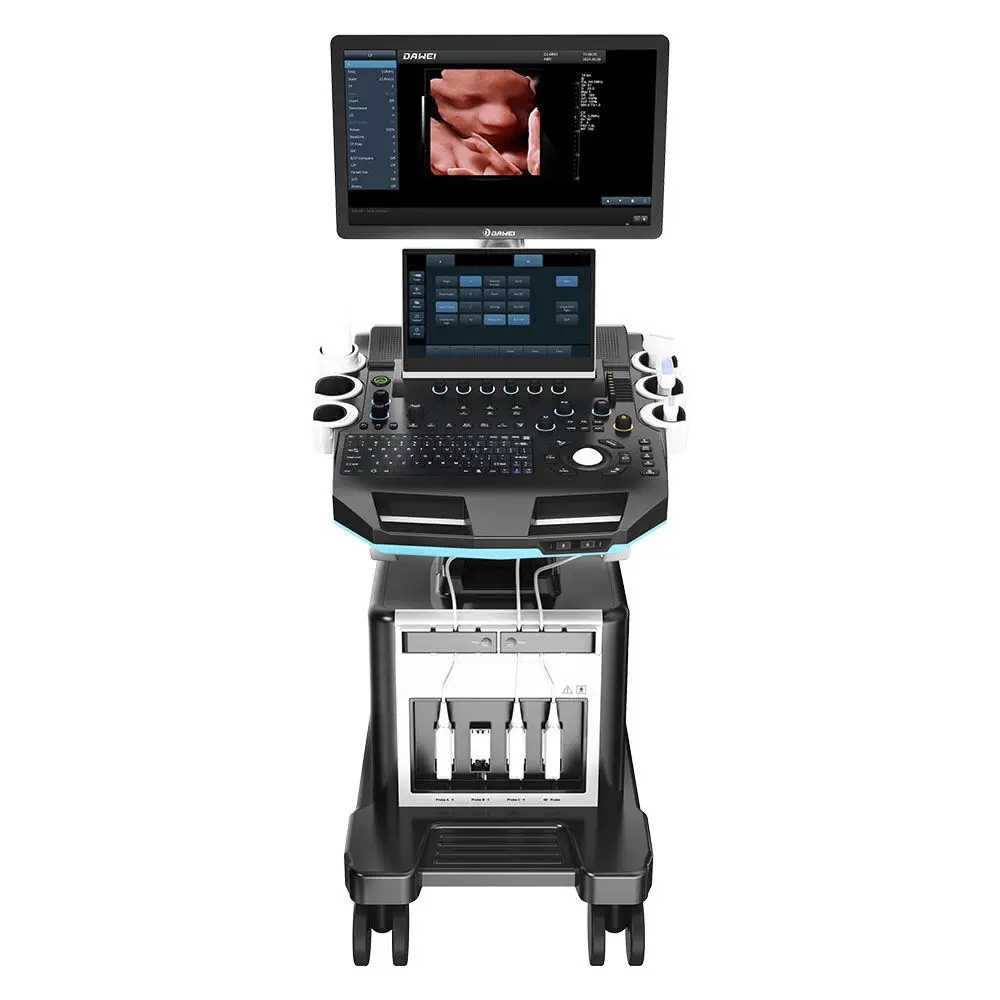 เครื่องตรวจอวัยวะภายในด้วยคลื่นเสียงความคมชัดสูง  Gynecological and obstetric ultrasound imaging system DW-T50  Dawei