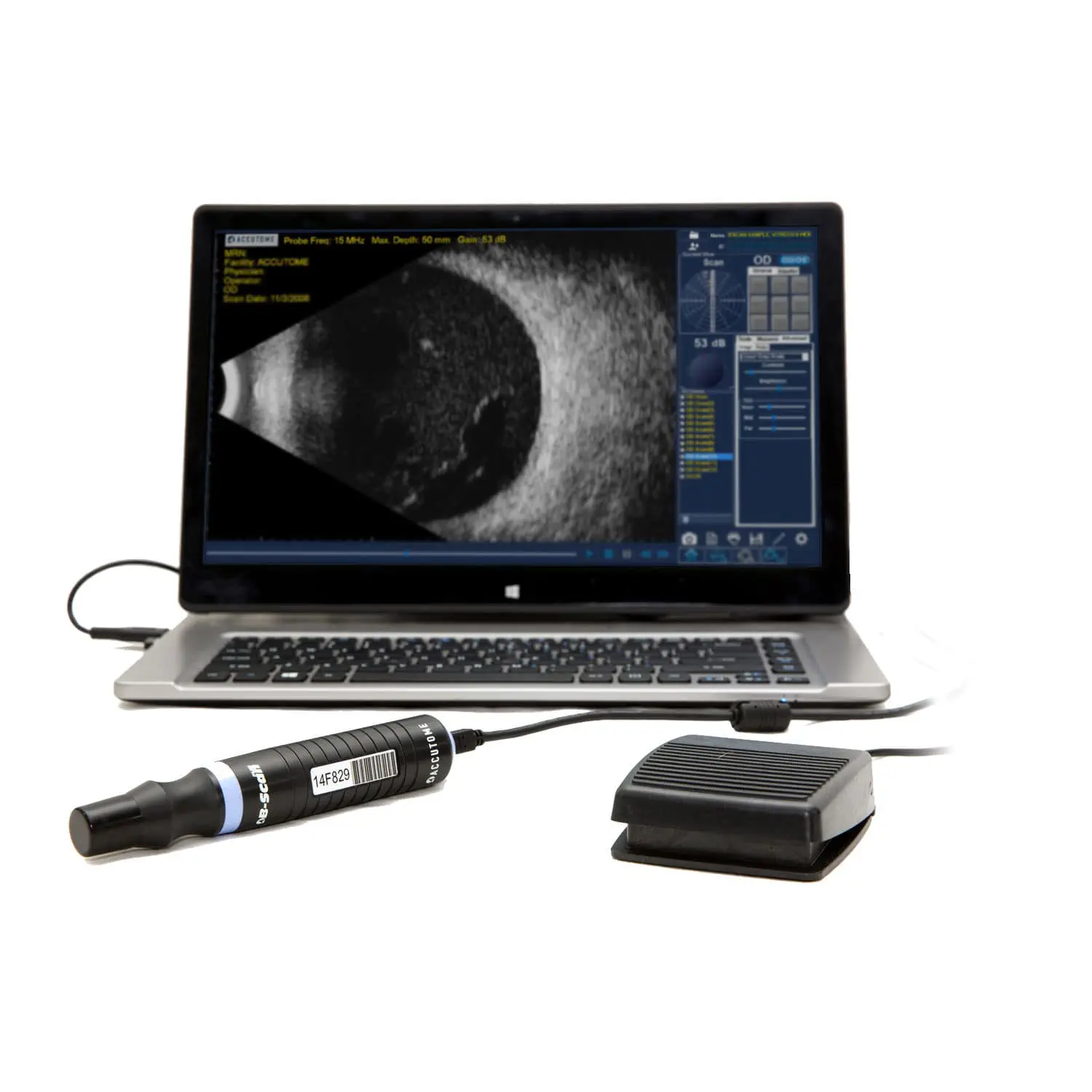เครื่องตรวจอวัยวะภายในด้วยคลื่นเสียงความคมชัดสูง  On-platform, tabletop ultrasound system B-Scan Plus  Keeler