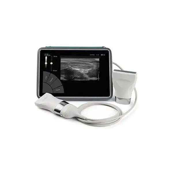 เครื่องตรวจอวัยวะภายในด้วยคลื่นเสียงความคมชัดสูง  On-platform, tabletop ultrasound system InVisus®  Natus