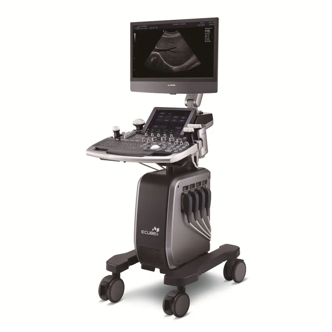 เครื่องตรวจอวัยวะภายในด้วยคลื่นเสียงความคมชัดสูง  On-platform ultrasound system E-CUBE 8 Series  Alpinion
