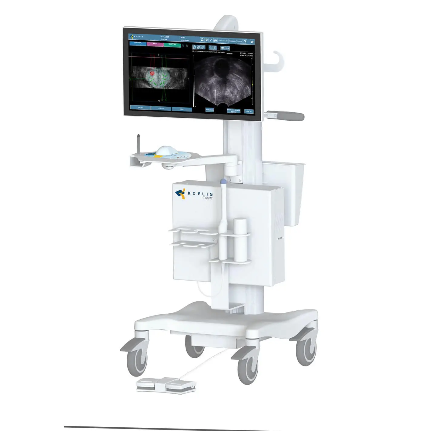 เครื่องตรวจอวัยวะภายในด้วยคลื่นเสียงความคมชัดสูง  On-platform ultrasound system Trinity®  Koelis