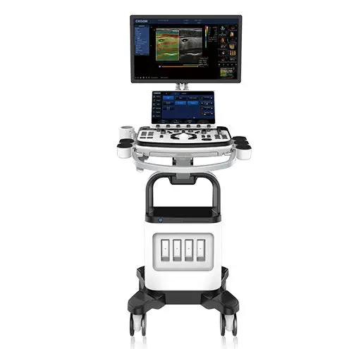 เครื่องตรวจอวัยวะภายในด้วยคลื่นเสียงความคมชัดสูง  On-platform ultrasound system XBit 80  CHISON