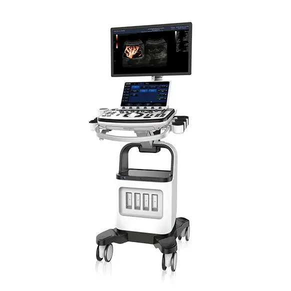 เครื่องตรวจอวัยวะภายในด้วยคลื่นเสียงความคมชัดสูง  On-platform ultrasound system XBit 90  CHISON