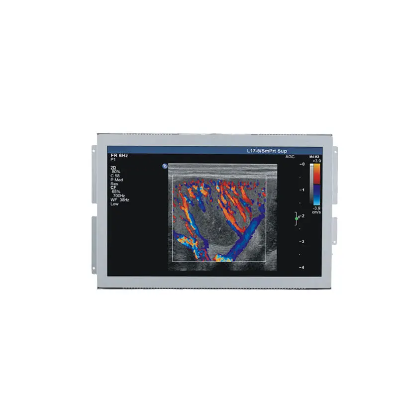เครื่องตรวจอวัยวะภายในด้วยคลื่นเสียงความคมชัดสูง  Ultrasound imaging display U156W  Beacon