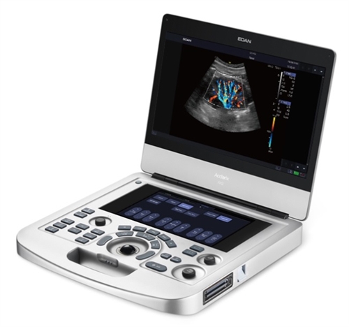 เครื่องตรวจอวัยวะภายในด้วยคลื่นเสียงความถี่สูงชนิดพกพา Ultrasound diagnotic system  Acclarix AX2  EDAN
